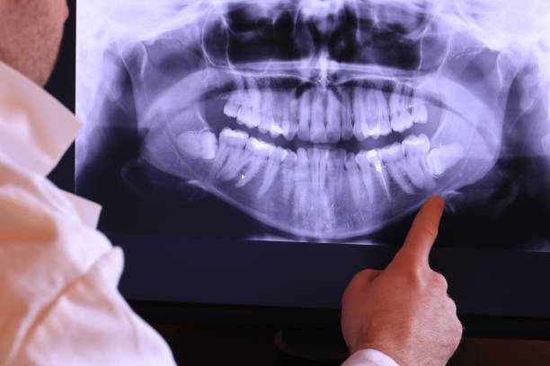 Best Weekend Emergency Dentist in Frazier Park, CA